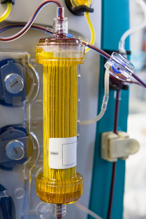 Blut besteht zu 40 Prozent aus Blutzellen und zu 60 Prozent aus Plasma (Foto), in dem wichtige Eiweiße, Salze und Hormone schwimmen.