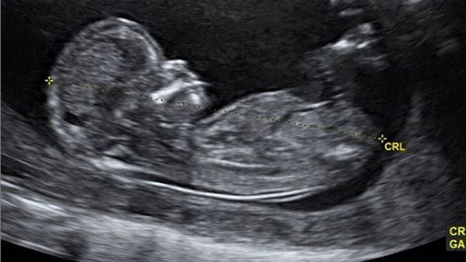 Das vermeintliche Bieber-Baby - nur ein Aprilscherz.